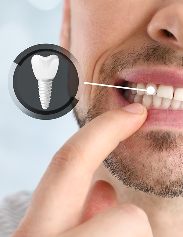 The image shows a close-up of a person s face with a focus on their teeth, featuring an illustration of a dental implant and a magnified view of a toothbrush in use.
